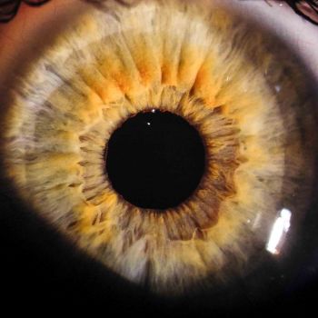 Iris Auge 11