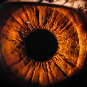 Iris Auge 12