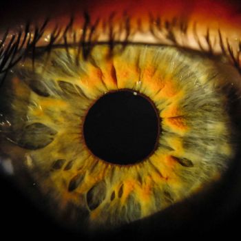 Iris Auge 13