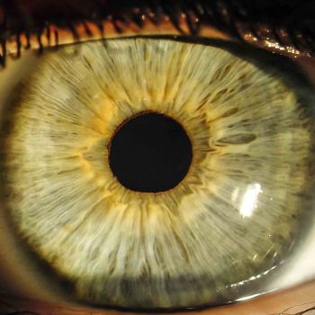 Iris Auge 14