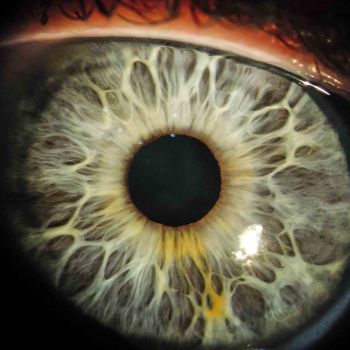 Iris Auge 16